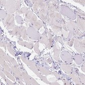 Anti-CD40 antibody produced in rabbit Prestige Antibodies® Powered by Atlas Antibodies, affinity isolated antibody, buffered aqueous glycerol solution