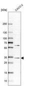 Anti-VDAC1 antibody produced in rabbit Prestige Antibodies® Powered by Atlas Antibodies, affinity isolated antibody, buffered aqueous glycerol solution