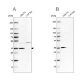 Anti-PCNA antibody produced in rabbit Prestige Antibodies® Powered by Atlas Antibodies, affinity isolated antibody, buffered aqueous glycerol solution, ab1