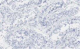 Anti-PER2 Antibody, clone 1G17 ZooMAb® Rabbit Monoclonal recombinant, expressed in HEK 293 cells
