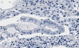 Anti-phospho-Chk2-Thr68 Antibody, clone 1B17 ZooMAb® Rabbit Monoclonal recombinant, expressed in HEK 293 cells