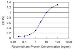 Monoclonal Anti-TPM3 antibody produced in mouse clone 2E4, purified immunoglobulin, buffered aqueous solution