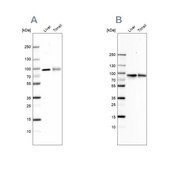 Anti-TF antibody produced in rabbit Ab2, Prestige Antibodies® Powered by Atlas Antibodies, affinity isolated antibody, buffered aqueous glycerol solution