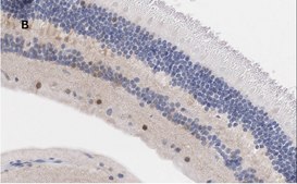 Anti-Brn3a Antibody, clone 4L5, ZooMAb® Rabbit Monoclonal recombinant, expressed in HEK 293 cells