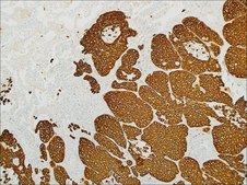 Cytokeratin 5 &amp; 6 (EP24 &amp; EP67) Rabbit Monoclonal Primary Antibody