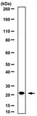 Anti-Chromobox protein homolog 3 Antibody from rabbit, purified by affinity chromatography