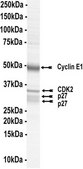 p27 Protein complex, activated, 10 µg Activated complex of three (3) full length, recombinant human proteins: p27, Cyclin E1, &amp; CDK2. Phosphorylated in vitro using CDK2/Cyclin E1. For use in Enzyme Assays. Behaves as a substrate in ubiquitin assays.