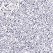 Anti-ABCC4 antibody produced in rabbit Prestige Antibodies® Powered by Atlas Antibodies, affinity isolated antibody, buffered aqueous glycerol solution
