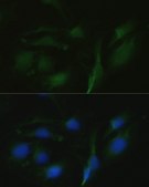 Anti-TRPV1 antibody produced in rabbit
