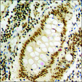 Anti-phospho-SAPK/JNK (pTyr185) antibody produced in rabbit affinity isolated antibody
