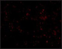 Anti-SCARB1 antibody produced in rabbit affinity isolated antibody, buffered aqueous solution