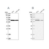Anti-PGM3 antibody produced in rabbit Prestige Antibodies® Powered by Atlas Antibodies, affinity isolated antibody, buffered aqueous glycerol solution, ab1