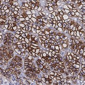 Anti-SCARB1 Prestige Antibodies® Powered by Atlas Antibodies, affinity isolated antibody
