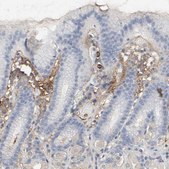 Anti-VCAN antibody produced in rabbit Prestige Antibodies® Powered by Atlas Antibodies, affinity isolated antibody, buffered aqueous glycerol solution