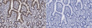 Anti-ATM Antibody, clone 4N19, ZooMAb® Rabbit Monoclonal recombinant, expressed in HEK 293 cells