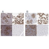 Anti-ICAM1 antibody produced in rabbit Prestige Antibodies® Powered by Atlas Antibodies, affinity isolated antibody, buffered aqueous glycerol solution