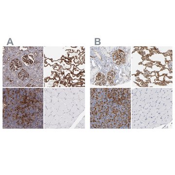 Anti-ICAM1 antibody produced in rabbit Prestige Antibodies® Powered by Atlas Antibodies, affinity isolated antibody, buffered aqueous glycerol solution