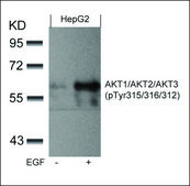 Anti-phospho-AKT1/AKT2/AKT3 (pTyr315/pTyr316/pTyr312) antibody produced in rabbit affinity isolated antibody