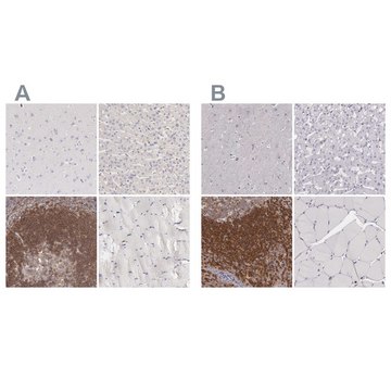 Anti-ARHGAP4 antibody produced in rabbit Ab2, Prestige Antibodies® Powered by Atlas Antibodies, affinity isolated antibody, buffered aqueous glycerol solution