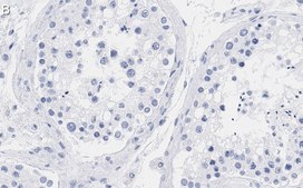 Anti-mTOR Antibody, clone 4O5 ZooMAb® Rabbit Monoclonal recombinant, expressed in HEK 293 cells
