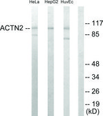 Anti-Actinin α antibody produced in rabbit affinity isolated antibody