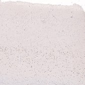 Monoclonal Anti-FOXP2 antibody produced in mouse Prestige Antibodies® Powered by Atlas Antibodies, clone CL5310, purified immunoglobulin, buffered aqueous glycerol solution