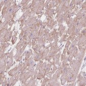 Anti-POPDC2 antibody produced in rabbit Prestige Antibodies® Powered by Atlas Antibodies, affinity isolated antibody, buffered aqueous glycerol solution