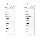 Anti-UFL1 antibody produced in rabbit Prestige Antibodies® Powered by Atlas Antibodies, affinity isolated antibody, buffered aqueous glycerol solution, ab2