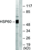 Anti-HSP60 antibody produced in rabbit affinity isolated antibody