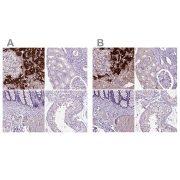 Anti-DBH antibody produced in rabbit Prestige Antibodies® Powered by Atlas Antibodies, affinity isolated antibody