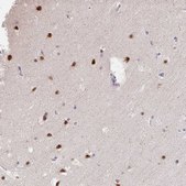 Anti-GTF2H1 antibody produced in rabbit Prestige Antibodies® Powered by Atlas Antibodies, affinity isolated antibody, buffered aqueous glycerol solution