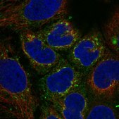 Anti-VTN antibody produced in rabbit Prestige Antibodies® Powered by Atlas Antibodies, affinity isolated antibody, buffered aqueous glycerol solution