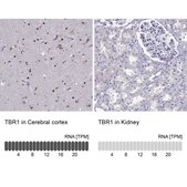 Anti-TBR1 Prestige Antibodies® Powered by Atlas Antibodies, affinity isolated antibody