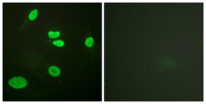 Anti-Histone H3 (Acetyl-Lys9) antibody produced in rabbit affinity isolated antibody