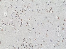 Anti-HDAC3 Rabbit Monoclonal Antibody clone RM439, affinity purified immunoglobulin