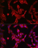 Anti-LDHA antibody produced in rabbit