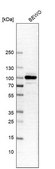Anti-BRAF antibody produced in rabbit Prestige Antibodies® Powered by Atlas Antibodies, affinity isolated antibody