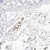 Anti-CAMP antibody produced in rabbit Prestige Antibodies® Powered by Atlas Antibodies, affinity isolated antibody, buffered aqueous glycerol solution