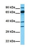 Anti-SLC6A2 antibody produced in rabbit affinity isolated antibody