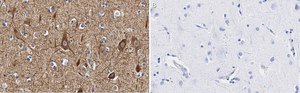 Anti-Neurofilament M Antibody, clone 1B23 ZooMAb® Rabbit Monoclonal recombinant, expressed in HEK 293 cells