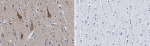 Anti-TOMM20 Antibody, clone 5H22 ZooMAb® Rabbit Monoclonal recombinant, expressed in HEK 293 cells