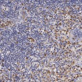 Anti-TLR8 antibody produced in rabbit Prestige Antibodies® Powered by Atlas Antibodies, affinity isolated antibody, buffered aqueous glycerol solution