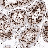 Monoclonal Anti-H2AFX antibody produced in mouse Prestige Antibodies® Powered by Atlas Antibodies, clone CL5157, purified immunoglobulin, buffered aqueous glycerol solution