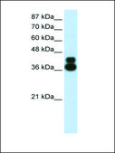 Anti-FOXJ1 antibody produced in rabbit affinity isolated antibody