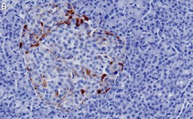 Anti-Glucagon Antibody, clone 6D6 ZooMAb® Rabbit Monoclonal recombinant, expressed in HEK 293 cells