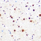 Anti-KLF4 antibody produced in rabbit