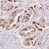 Monoclonal Anti-ANLN antibody produced in mouse Prestige Antibodies® Powered by Atlas Antibodies, clone CL0303, purified immunoglobulin, buffered aqueous glycerol solution