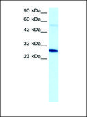 Anti-PARP1 antibody produced in rabbit IgG fraction of antiserum