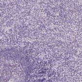 Anti-CYP11B1 antibody produced in rabbit Prestige Antibodies® Powered by Atlas Antibodies, affinity isolated antibody, buffered aqueous glycerol solution