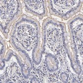 Anti-ABCB1 antibody produced in rabbit Prestige Antibodies® Powered by Atlas Antibodies, affinity isolated antibody, buffered aqueous glycerol solution